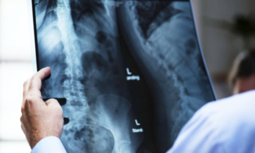 doctor reading an x-ray image using diagnostic imaging technology